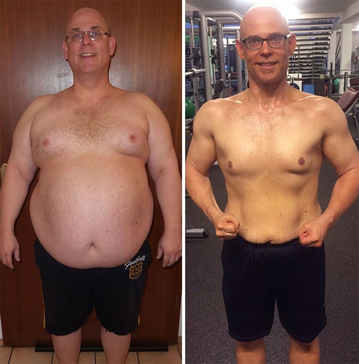Antes e depois de usuário IronShape
